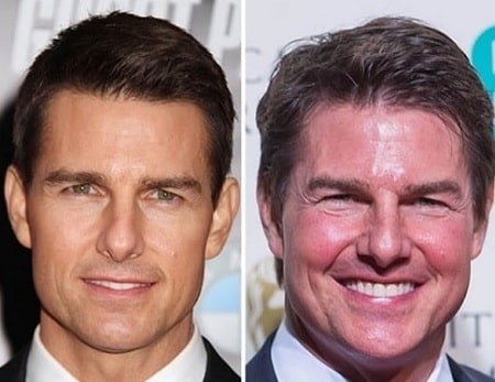 A before and after picture of Tom Cruise.